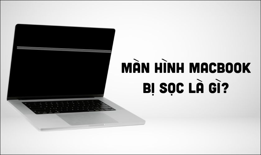 Lỗi màn hình MacBook bị sọc ngang và dọc là gì?