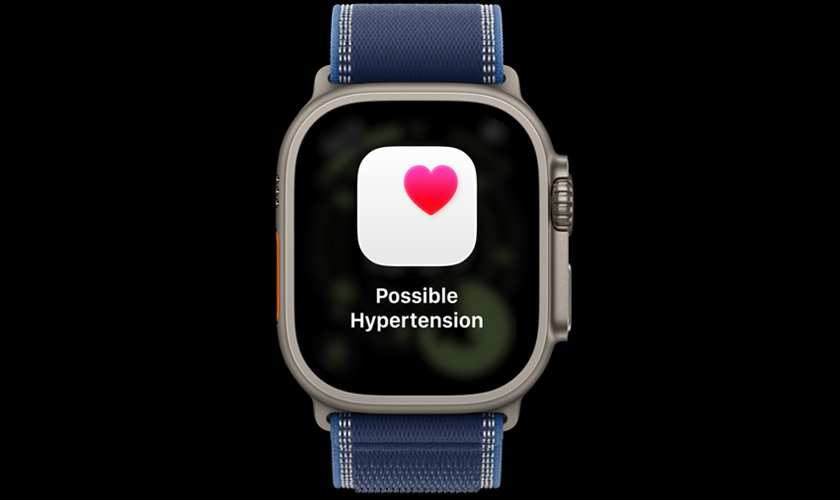 Lý do bạn nên chọn thay pin Apple Watch Ultra 3 chính hãng tại CareS