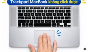 Trackpad MacBook không click được: Nguyên nhân và cách sửa